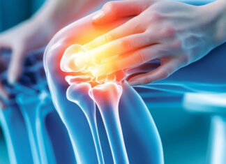 Kiedy ból kolana wymaga wizyty u ortopedy, a kiedy fizjoterapeuty? ból kolana